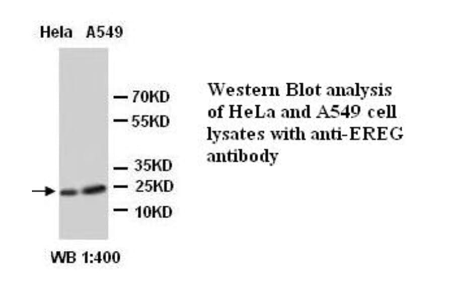 EREG Antibody from Signalway Antibody (39290) - Antibodies.com