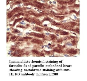 HERG Antibody from Signalway Antibody (39301) - Antibodies.com