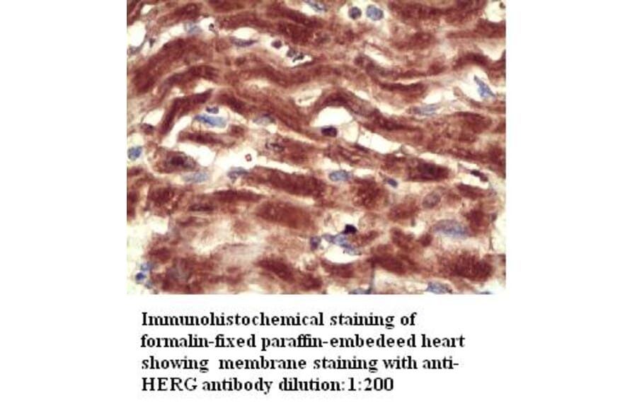 HERG Antibody from Signalway Antibody (39301) - Antibodies.com