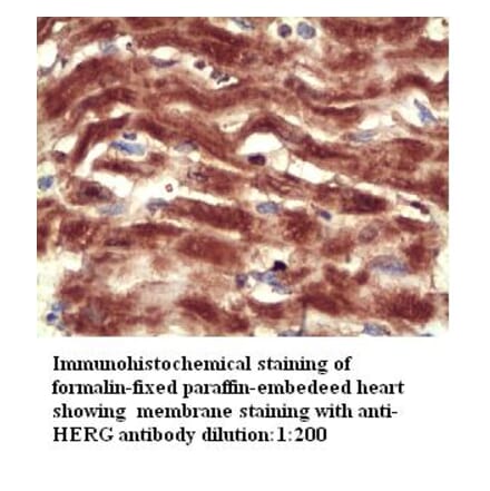 HERG Antibody from Signalway Antibody (39301) - Antibodies.com