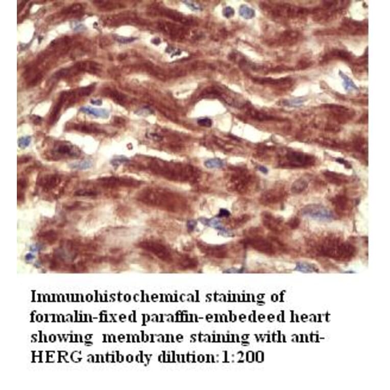 HERG Antibody from Signalway Antibody (39301) - Antibodies.com