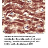 HERG Antibody from Signalway Antibody (39301) - Antibodies.com