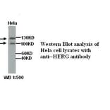 HERG Antibody from Signalway Antibody (39301) - Antibodies.com