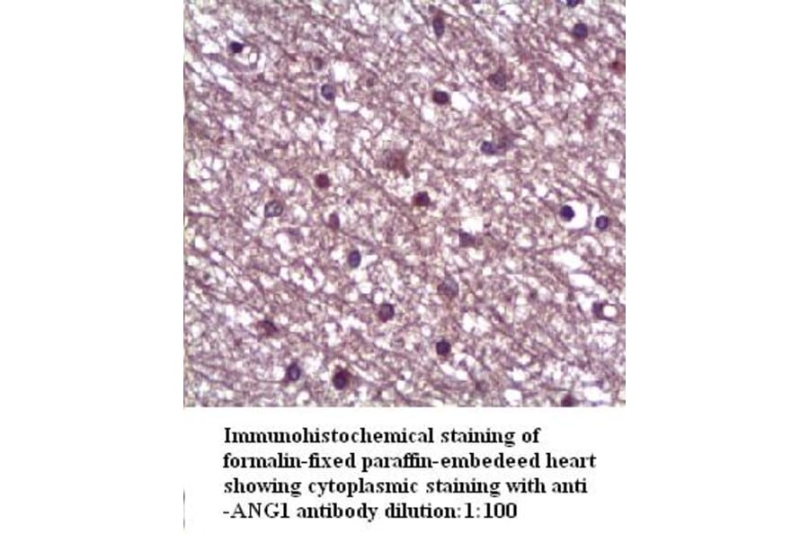 ANG1 Antibody from Signalway Antibody (39317) - Antibodies.com