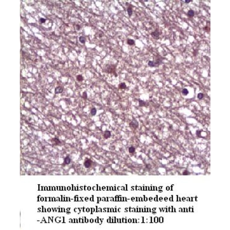 ANG1 Antibody from Signalway Antibody (39317) - Antibodies.com