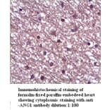 ANG1 Antibody from Signalway Antibody (39317) - Antibodies.com