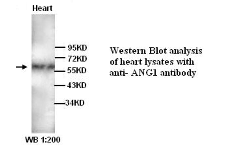 ANG1 Antibody from Signalway Antibody (39317) - Antibodies.com
