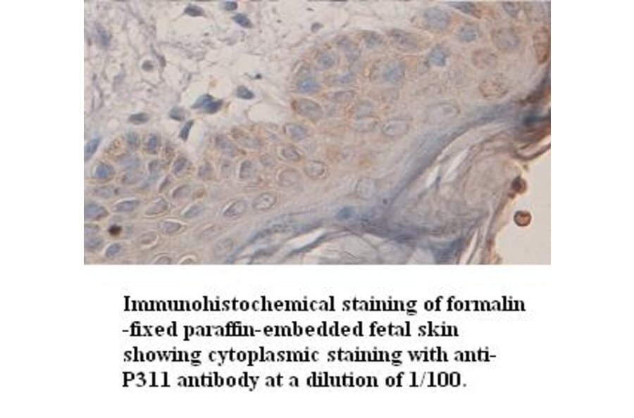 P311 Antibody from Signalway Antibody (39353) - Antibodies.com