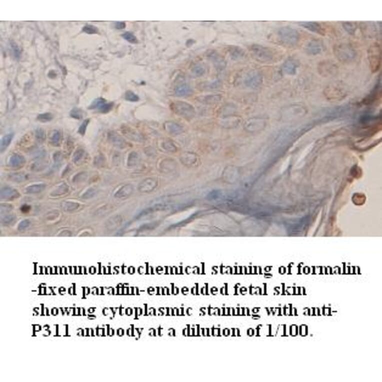 P311 Antibody from Signalway Antibody (39353) - Antibodies.com