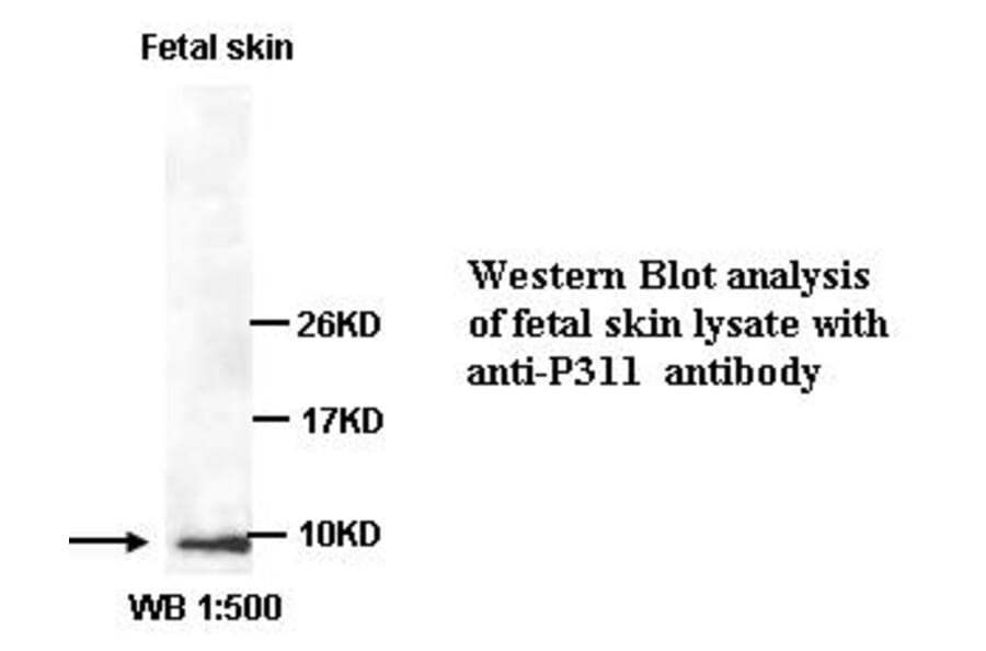 P311 Antibody from Signalway Antibody (39353) - Antibodies.com
