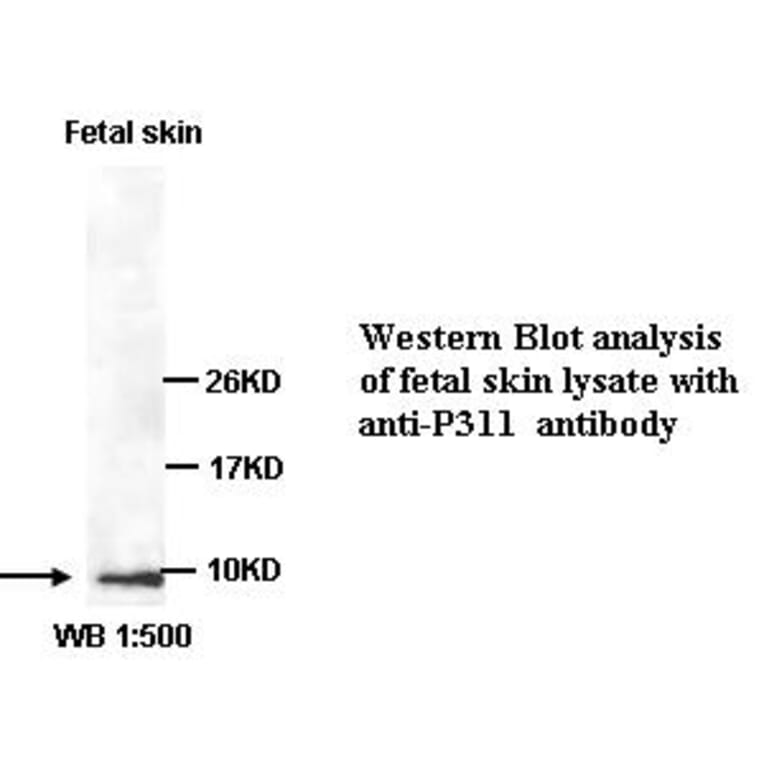 P311 Antibody from Signalway Antibody (39353) - Antibodies.com