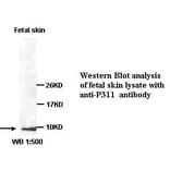 P311 Antibody from Signalway Antibody (39353) - Antibodies.com