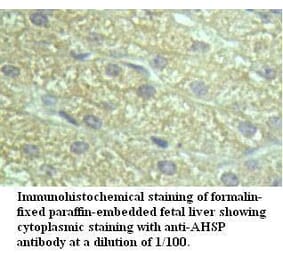 AHSP Antibody from Signalway Antibody (39497) - Antibodies.com