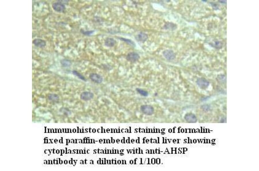 AHSP Antibody from Signalway Antibody (39497) - Antibodies.com
