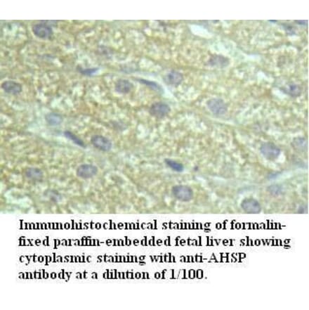 AHSP Antibody from Signalway Antibody (39497) - Antibodies.com