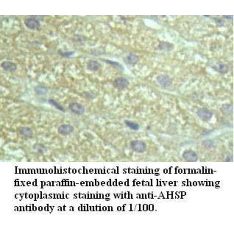AHSP Antibody from Signalway Antibody (39497) - Antibodies.com