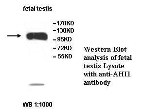 Anti-AHI1 Antibody