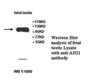 AHI1 Antibody from Signalway Antibody (39517) - Antibodies.com