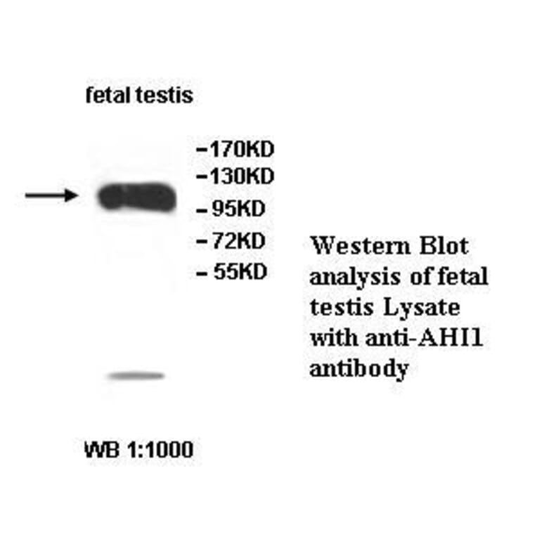 AHI1 Antibody from Signalway Antibody (39517) - Antibodies.com