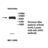 AHI1 Antibody from Signalway Antibody (39517) - Antibodies.com