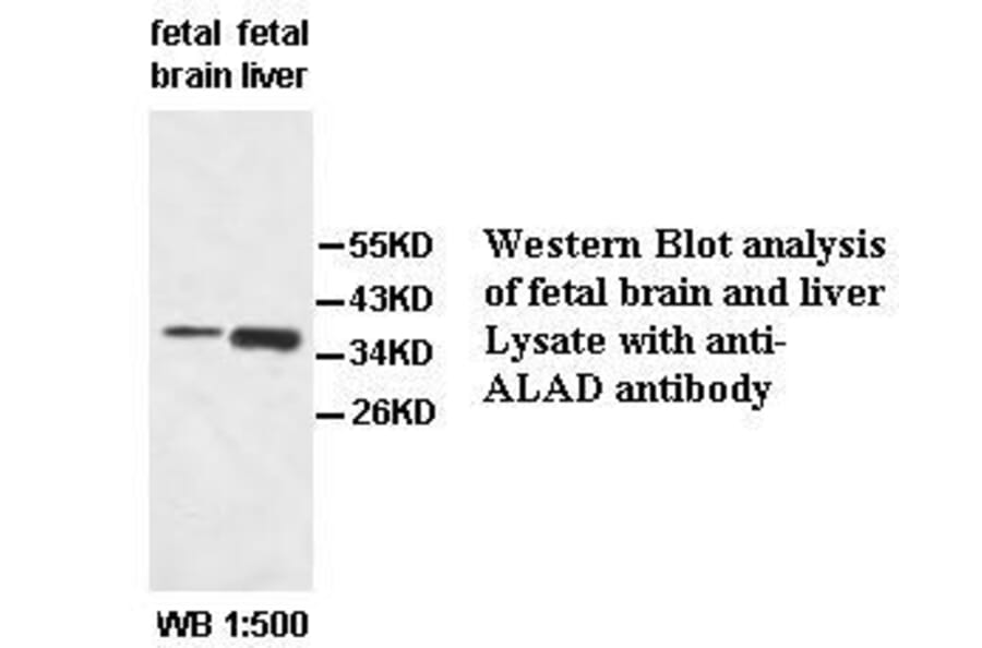 ALAD Antibody from Signalway Antibody (39521) - Antibodies.com