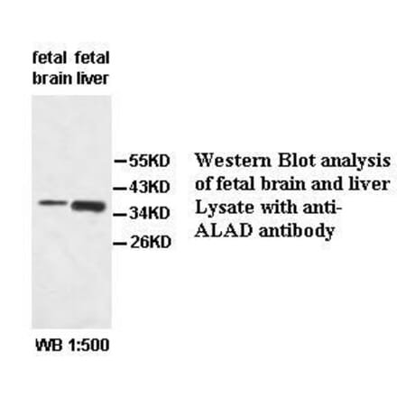 ALAD Antibody from Signalway Antibody (39521) - Antibodies.com