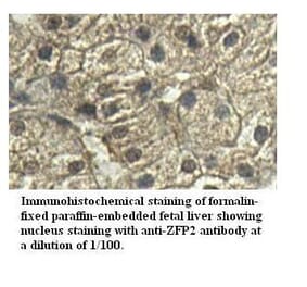 ZFP2 Antibody from Signalway Antibody (39529) - Antibodies.com