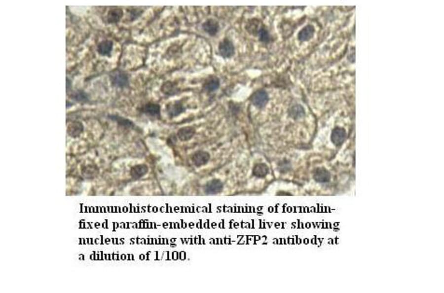 ZFP2 Antibody from Signalway Antibody (39529) - Antibodies.com