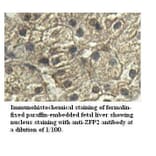 ZFP2 Antibody from Signalway Antibody (39529) - Antibodies.com