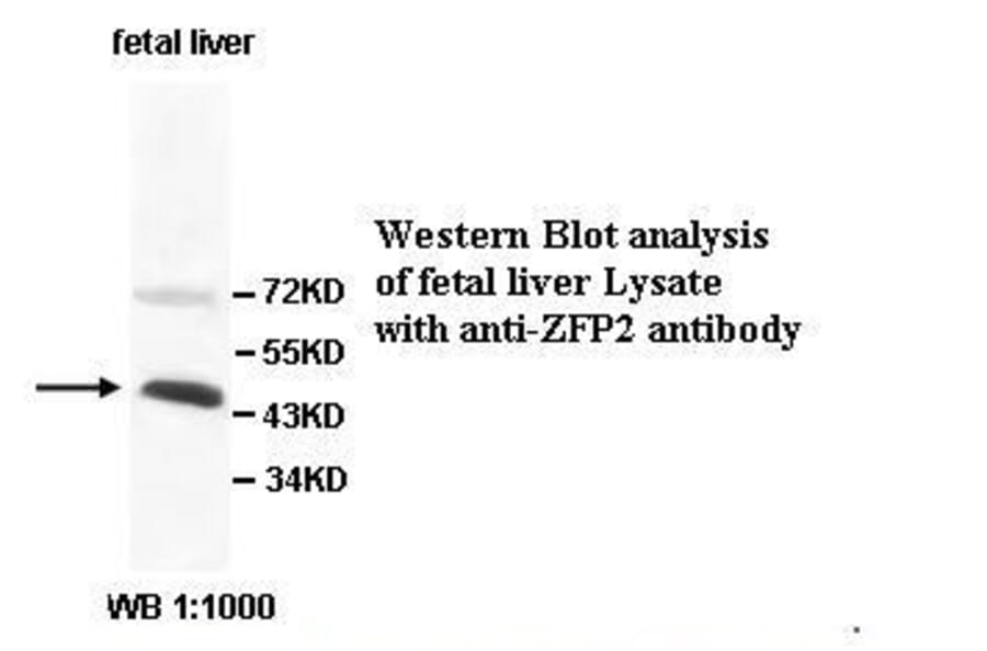ZFP2 Antibody from Signalway Antibody (39529) - Antibodies.com