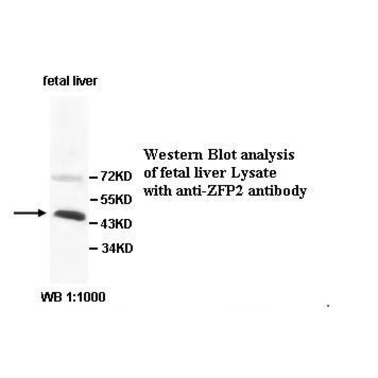 ZFP2 Antibody from Signalway Antibody (39529) - Antibodies.com
