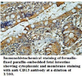 CD13 Antibody from Signalway Antibody (39696) - Antibodies.com