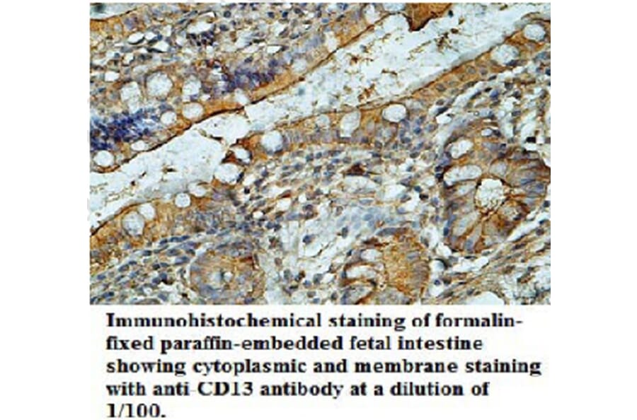 CD13 Antibody from Signalway Antibody (39696) - Antibodies.com