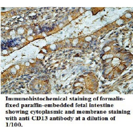 CD13 Antibody from Signalway Antibody (39696) - Antibodies.com