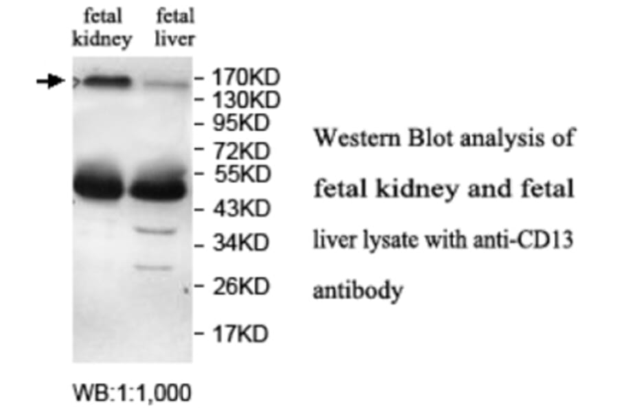 CD13 Antibody from Signalway Antibody (39696) - Antibodies.com