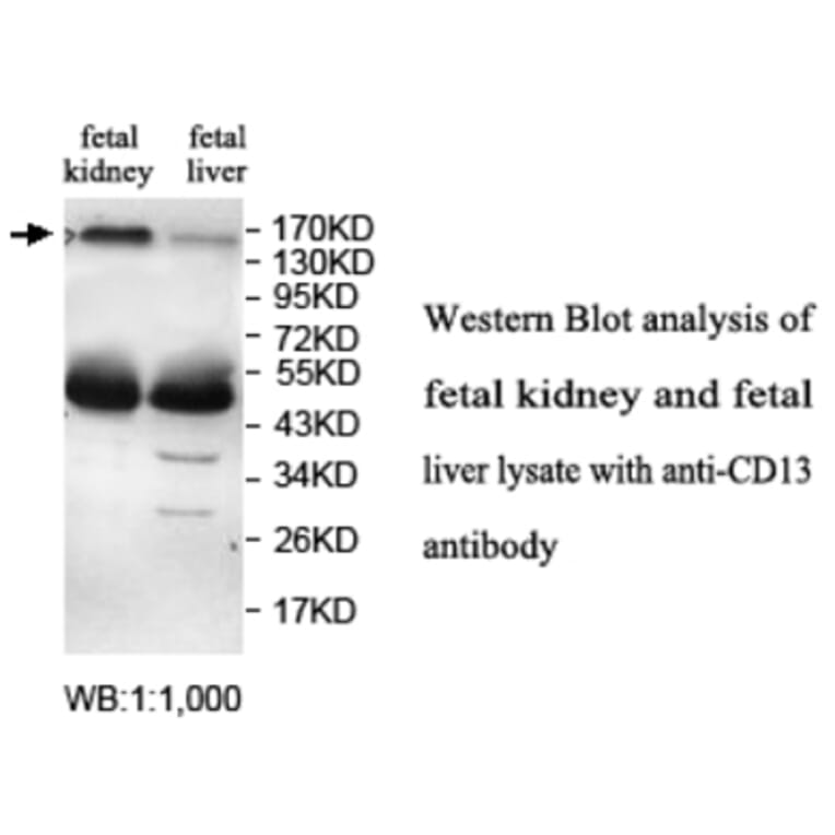 CD13 Antibody from Signalway Antibody (39696) - Antibodies.com