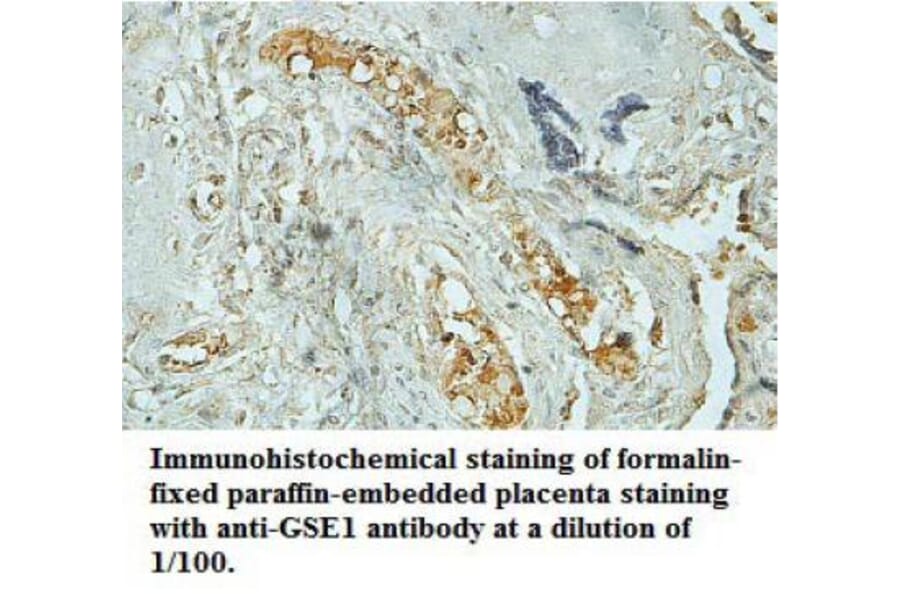 GSE1 Antibody from Signalway Antibody (39709) - Antibodies.com