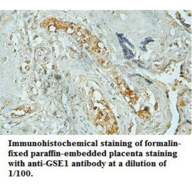 GSE1 Antibody from Signalway Antibody (39709) - Antibodies.com