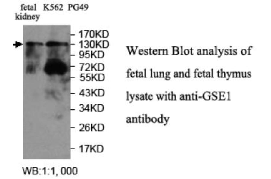GSE1 Antibody from Signalway Antibody (39709) - Antibodies.com