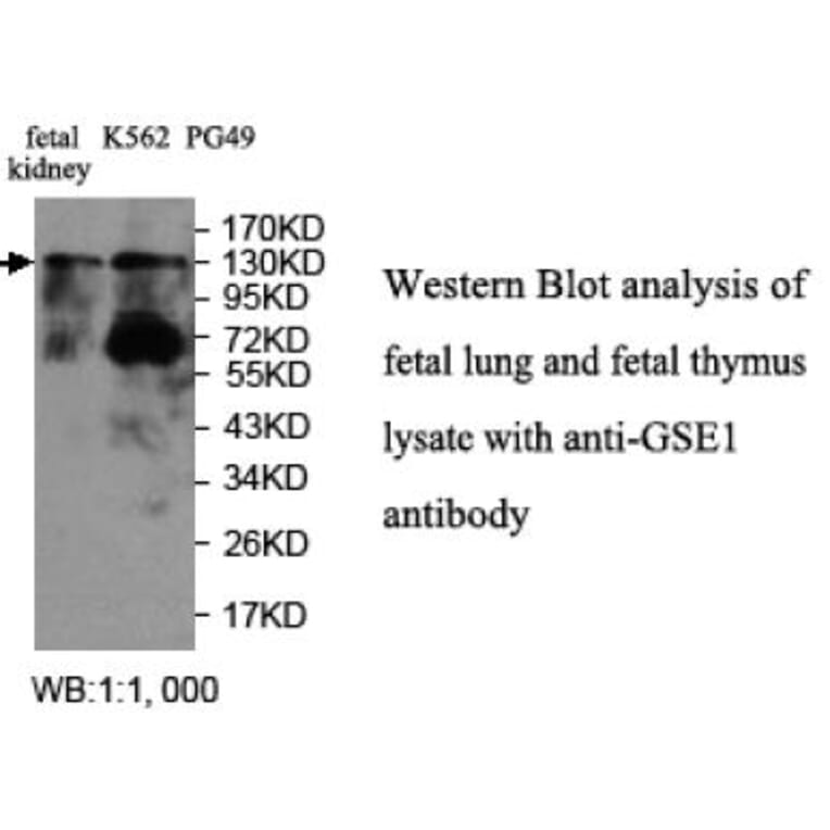 GSE1 Antibody from Signalway Antibody (39709) - Antibodies.com