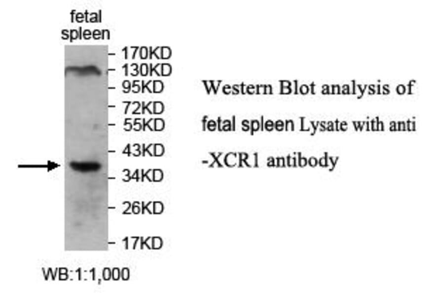 XCR1 Antibody from Signalway Antibody (39712) - Antibodies.com