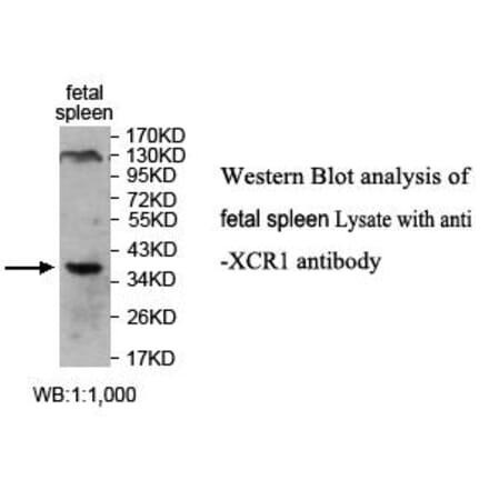 XCR1 Antibody from Signalway Antibody (39712) - Antibodies.com
