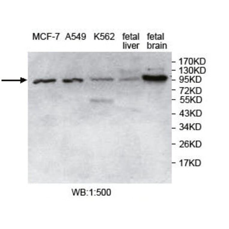 USP5 Antibody from Signalway Antibody (39748) - Antibodies.com