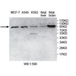 USP5 Antibody from Signalway Antibody (39748) - Antibodies.com