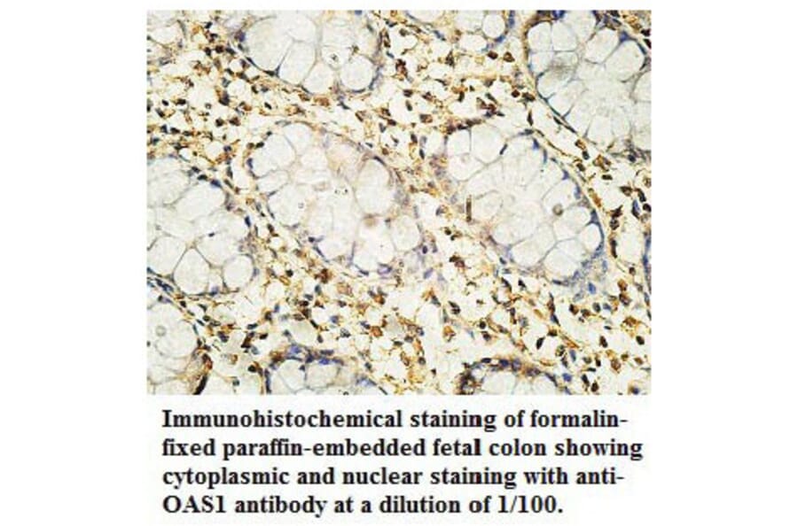 OAS1 Antibody from Signalway Antibody (39760) - Antibodies.com