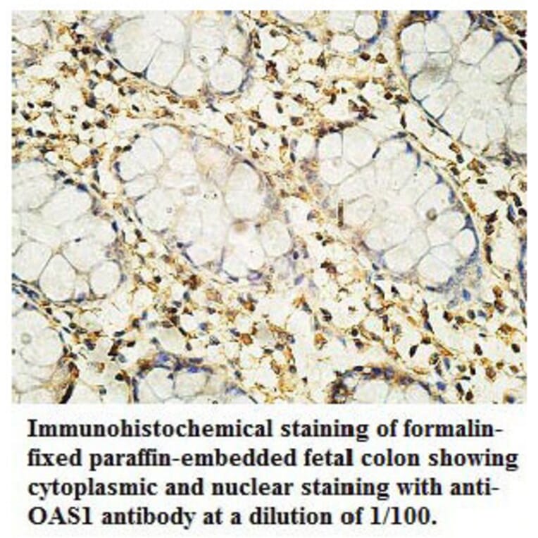 OAS1 Antibody from Signalway Antibody (39760) - Antibodies.com