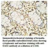 OAS1 Antibody from Signalway Antibody (39760) - Antibodies.com