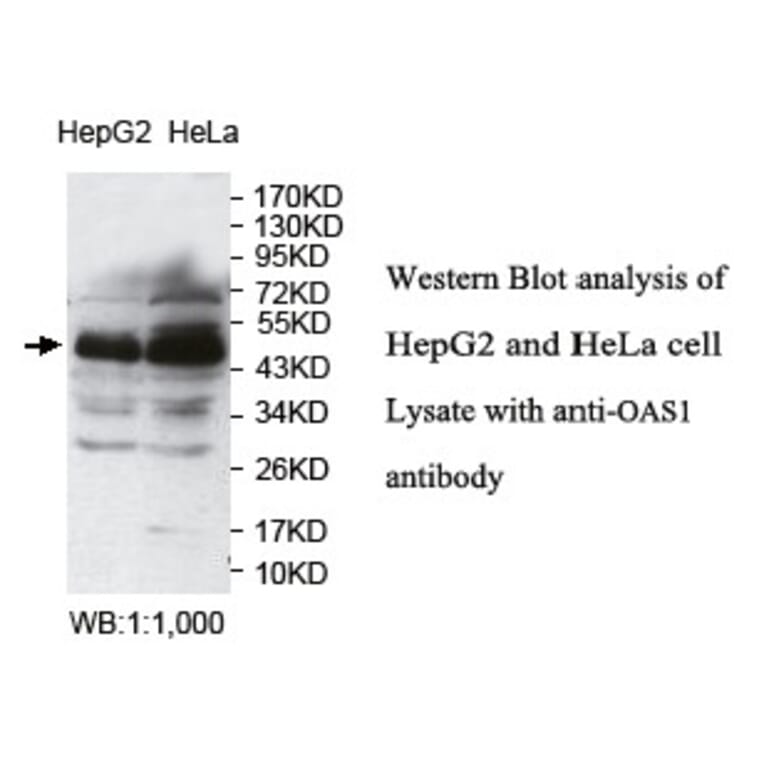 OAS1 Antibody from Signalway Antibody (39760) - Antibodies.com
