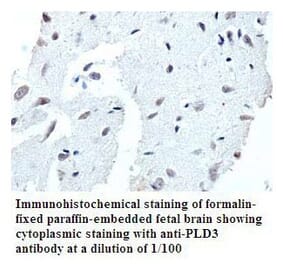 PLD3 Antibody from Signalway Antibody (39791) - Antibodies.com