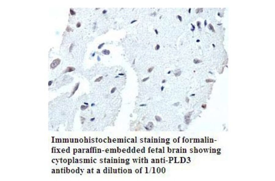 PLD3 Antibody from Signalway Antibody (39791) - Antibodies.com